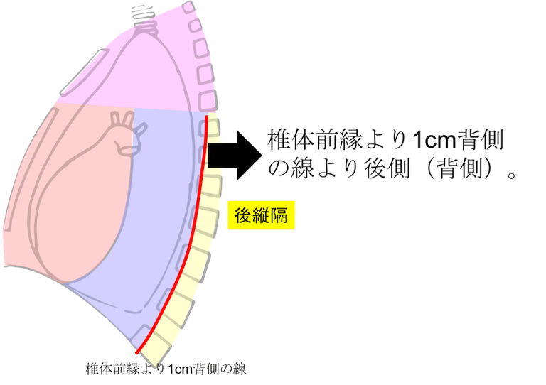 CT画像・図あり】縦隔とは？解剖・含まれる臓器をわかりやすく解説！